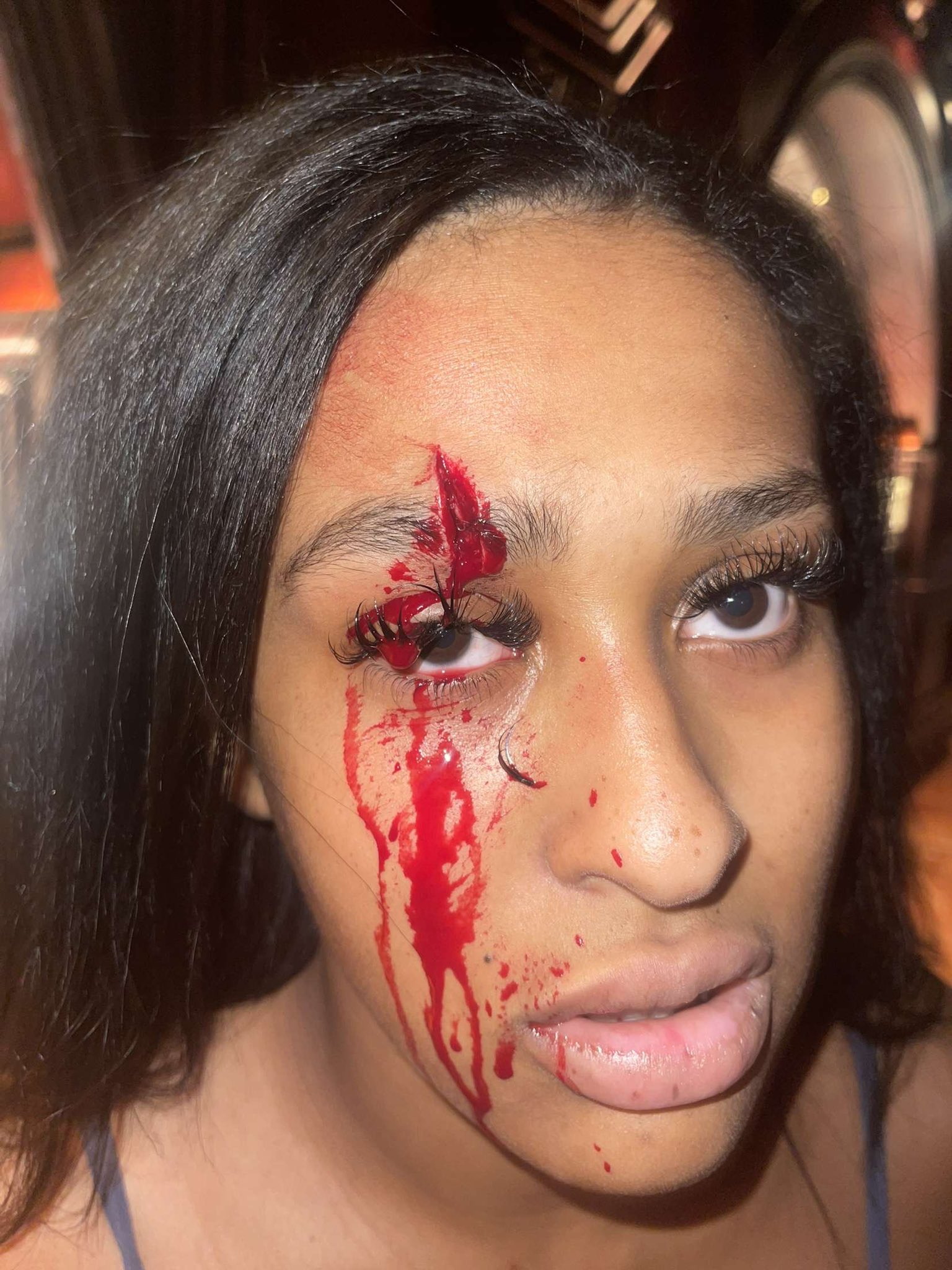 Jaaden Kyrelle✨ on X: 15 stitches to my face after he split my head open  infront of multiple other content creators. t.coG2emQJwnk1  X