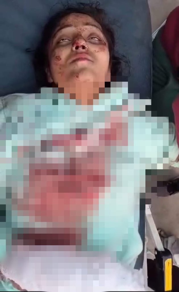 परीक्षा देने जाते समय ट्रेन से फेंक दिया गया था। #शौकत_अली के निर्देश पर मुझ पर हमला किया गया और चलती ट्रेन से फेंक दिया गया. मैंने अपना एक हाथ और पैर खो दिया और बाद में चोटों के कारण मेरी मौत हो गई। 

#मोतिहारी बिहार की रहने वाली शिवानी पांडे