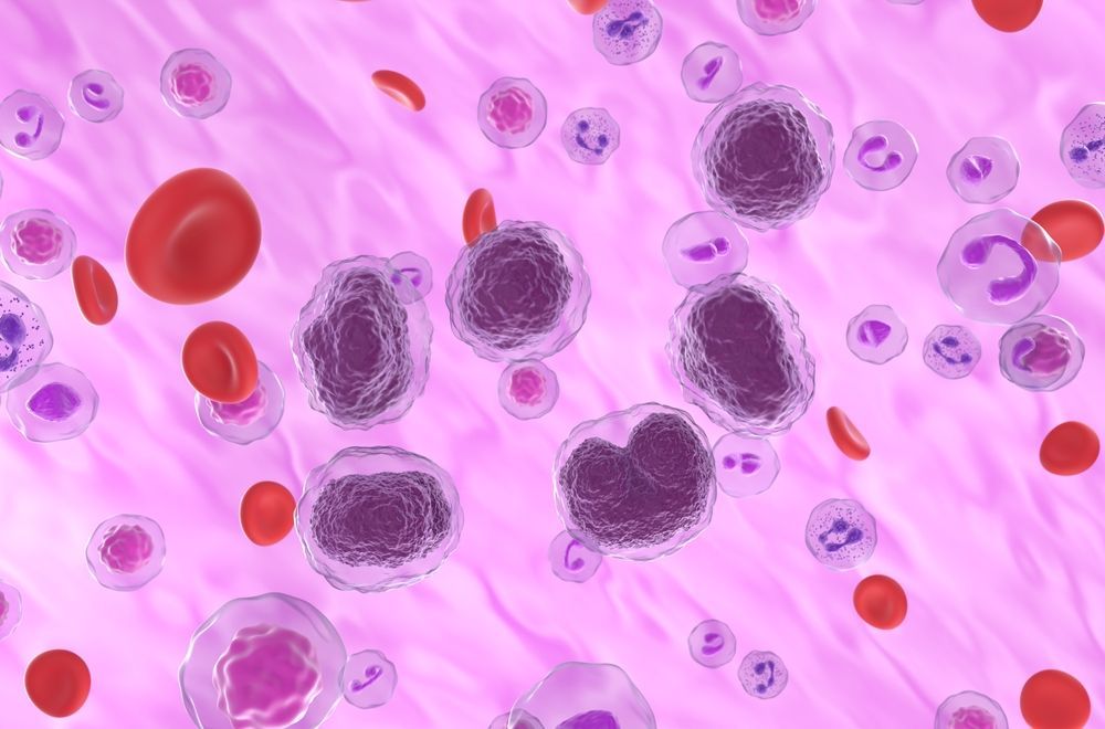 Blood Cancers Today (@blood_cancers) on Twitter photo The first human trial of novel anti-CD19 CAR T-Cell therapy shows promising phase I outcomes in patients with B-cell non-Hodgkin lymphoma.
Read more about the trial, led by <a href="/robweinkove/">Robert Weinkove</a> of <a href="/Malaghan_Inst/">Malaghan Institute</a>. #ASH23
📰 buff.ly/3GW2D0A The first human trial of novel anti-CD19 CAR T-Cell therapy shows promising phase I outcomes in patients with B-cell non-Hodgkin lymphoma.
Read more about the trial, led by <a href="/robweinkove/">Robert Weinkove</a> of <a href="/Malaghan_Inst/">Malaghan Institute</a>. #ASH23
📰 buff.ly/3GW2D0A