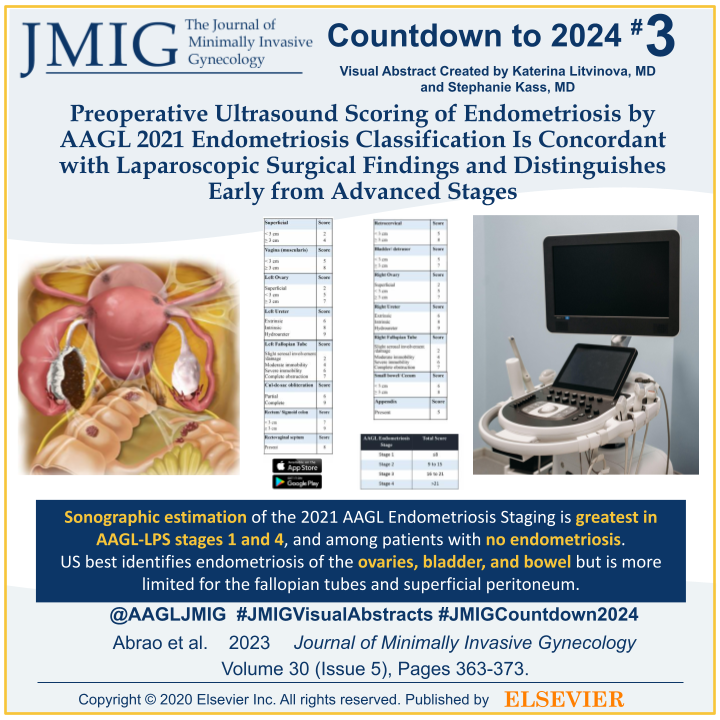 #JMIGCountdownto2024! The #3 most downloaded #JMIG article of 2023 is: 'Preoperative Ultrasound Scoring of Endometriosis by AAGL 2021 Endometriosis Classification Is Concordant with Laparoscopic Surgical Findings and Distinguishes Early from Advanced Stages'.