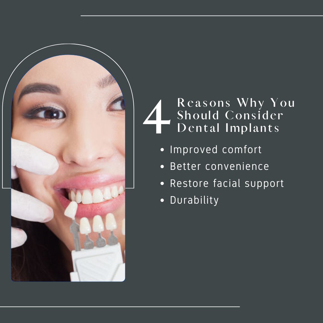 4 Reasons Why You Should Consider Dental Implants.