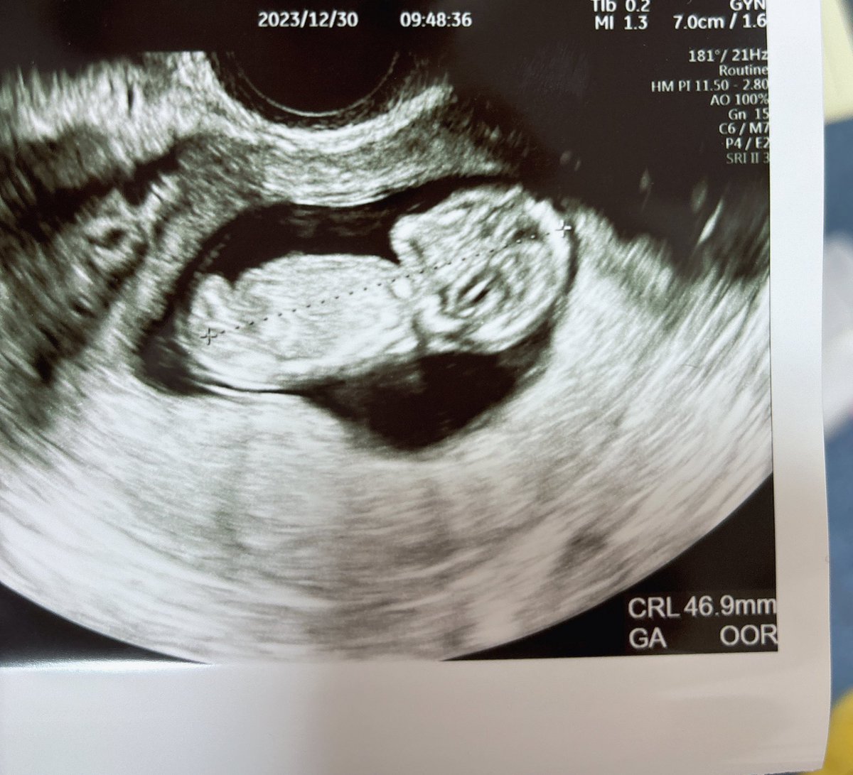 お久しぶりです✋
昨日の林檎さん堪んなかったですね💖
そういへば最近、 妊婦になりました！