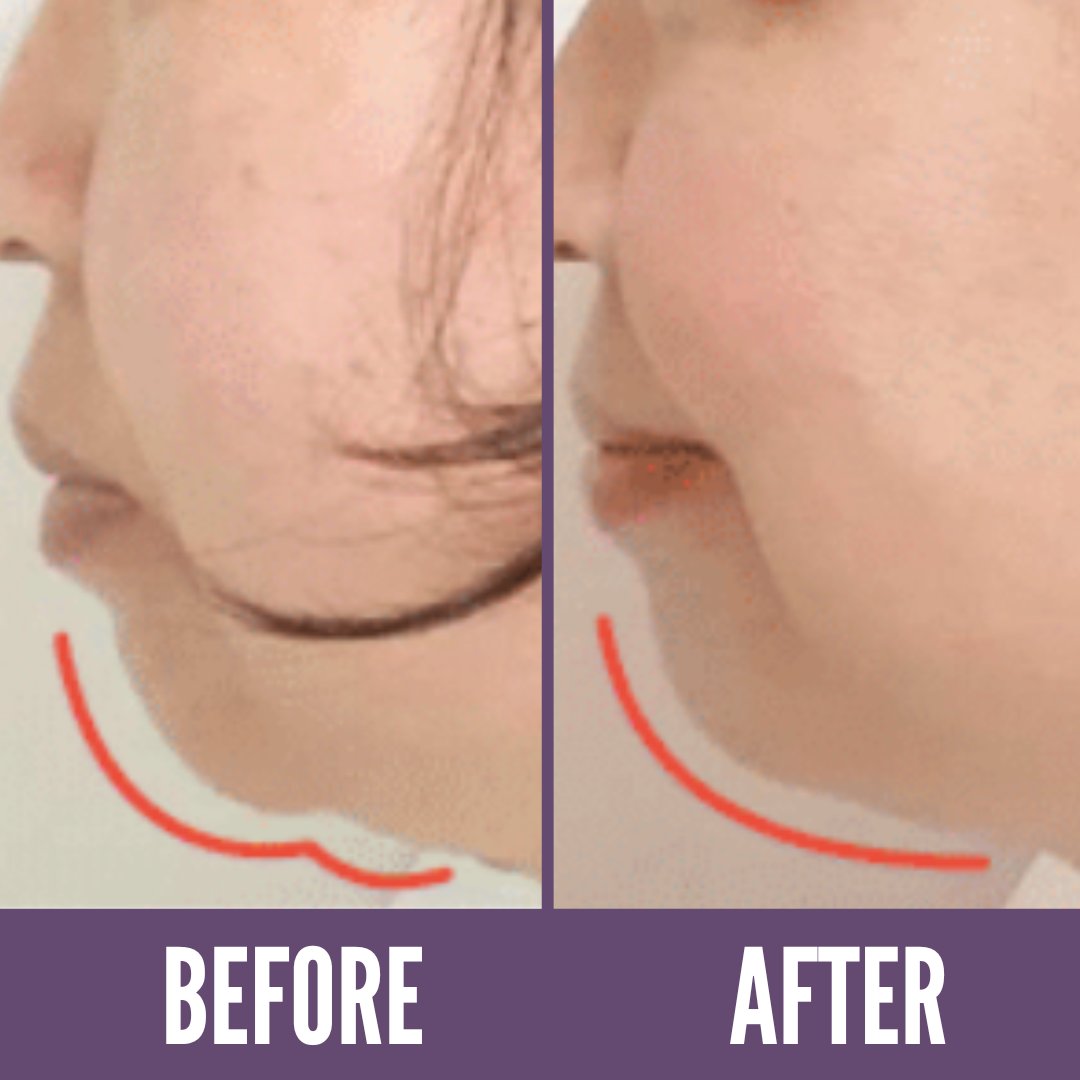 Young man with double chin on pink background, closeup — Stock Photo ©  NewAfrica #317399428, image size:1080x1080