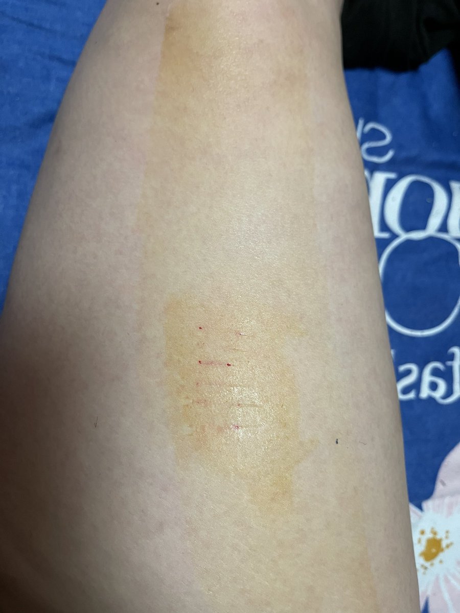 初次尝试，某人说他好长时间没练了，技术退步了……让我给他点时间练习练习
#穿刺