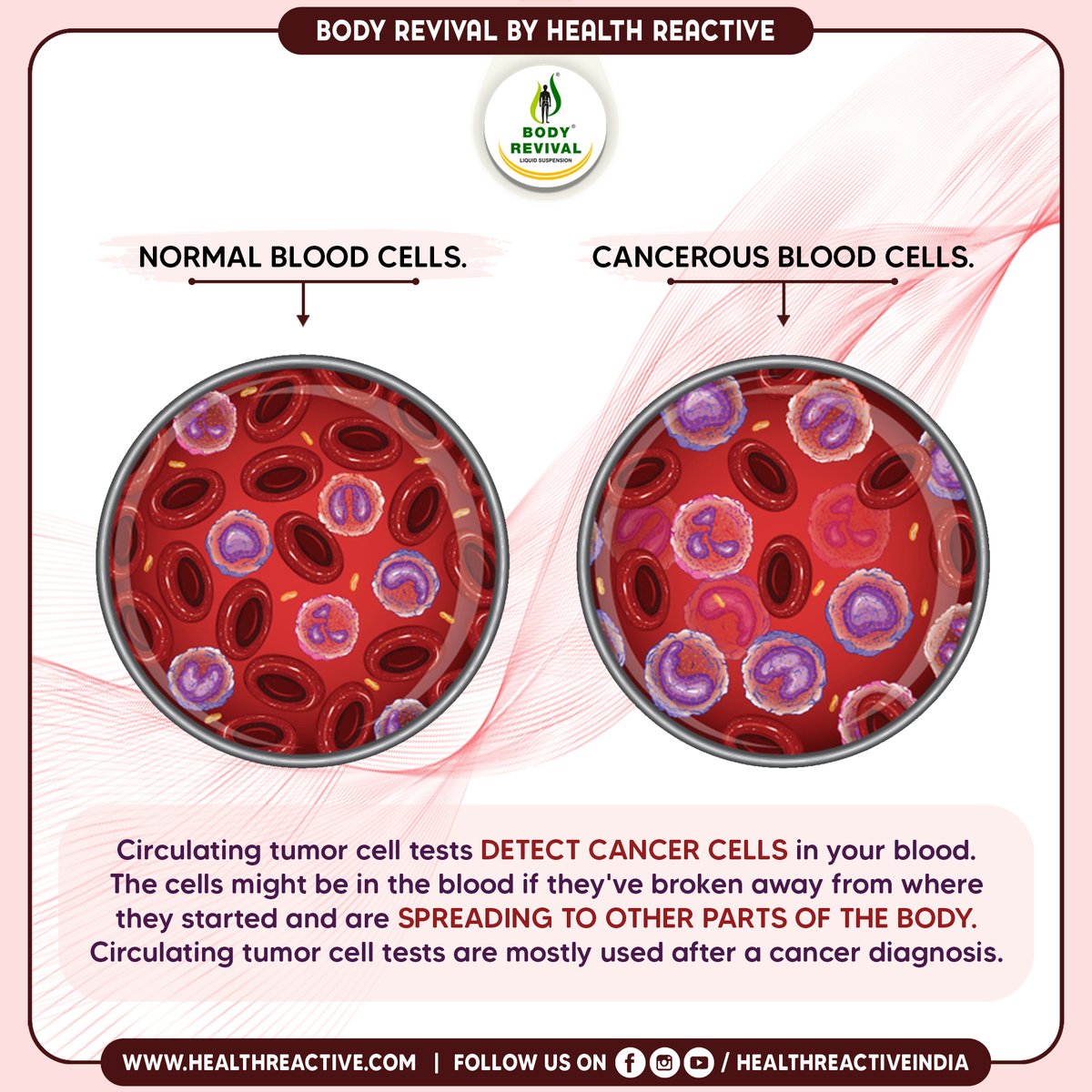 healthreactivee's tweet image. Detecting cancer cells often involves advanced medical techniques such as biopsies, imaging tests, and blood markers. Early detection is crucial for successful treatment and improved outcomes in the fight against cancer.

For More Follow Us
healthreactive.com

#cancercell