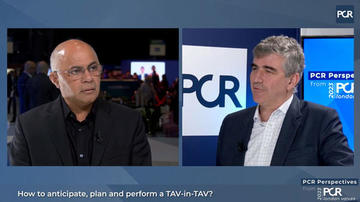 PCRonline 🫀 (@pcronline) on Twitter photo PCR Perspectives: How to anticipate, plan and perform a TAV-in-TAV
Although #TAVI has become routine, it is now long-term durability and the planning of a second procedure, particularly in younger patients, that is of interest.
<a href="/bapat_savrtavr/">vinayak bapat</a> and Bernard Prendergast discuss PCR Perspectives: How to anticipate, plan and perform a TAV-in-TAV
Although #TAVI has become routine, it is now long-term durability and the planning of a second procedure, particularly in younger patients, that is of interest.
<a href="/bapat_savrtavr/">vinayak bapat</a> and Bernard Prendergast discuss