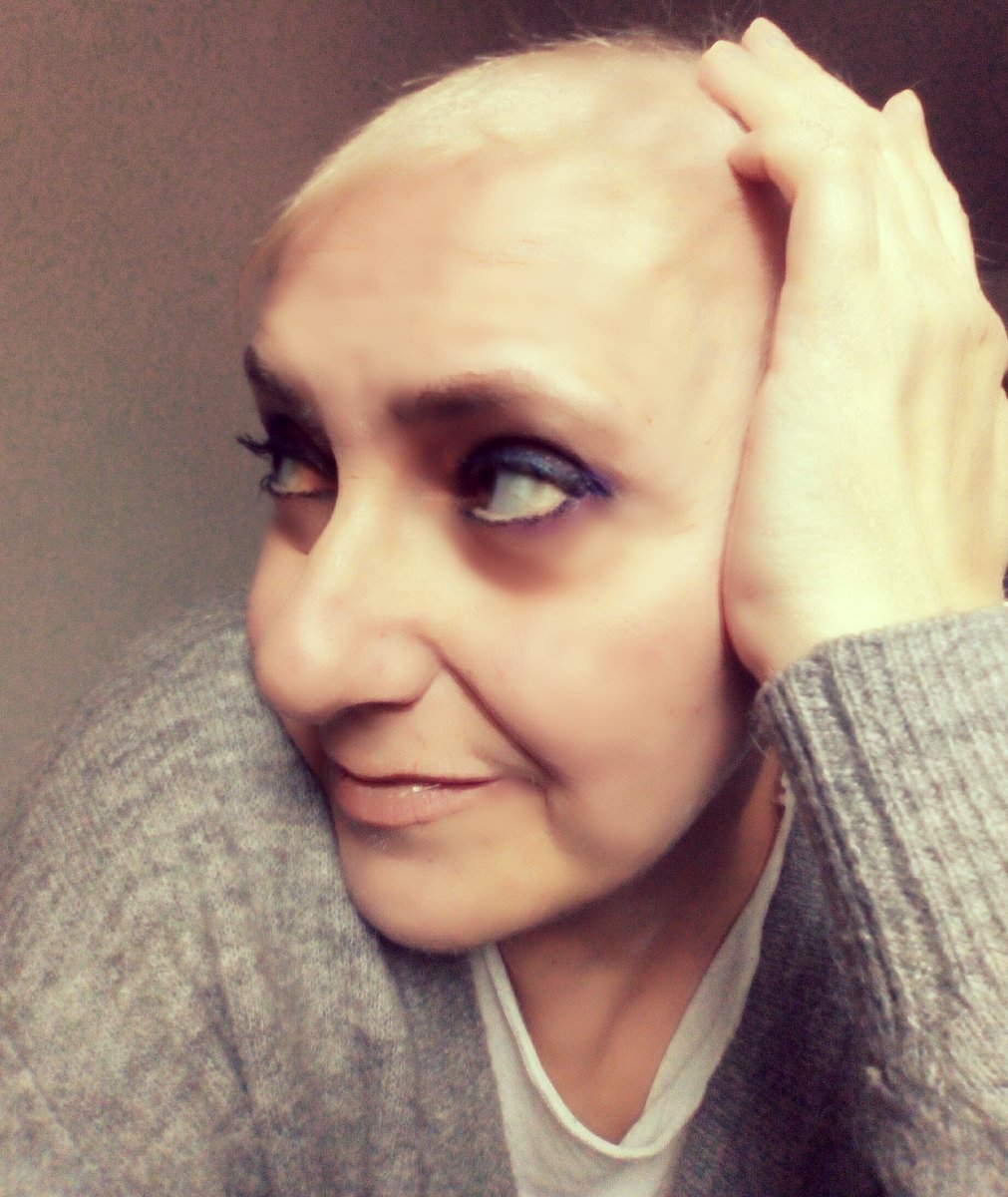 pettymagpie's tweet photo. L'alopecia da chemio non è una colpa, una cosa da nascondere, di cui vergognarsi  

Detto questo... speriamo ricrescano presto 😁 
Un abbraccio forte e speciale a tutte le donne nella mia situazione. https://t.co/QN899etC3M