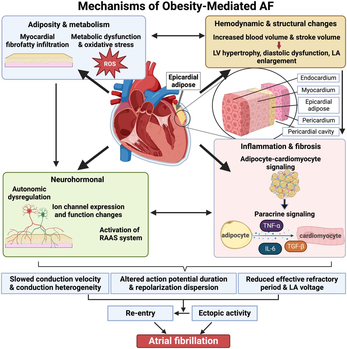 Our review on 'Impact of #Obesity on #Atrial_Fibrillation Pathogenesis and Treatment Optionsis' is out in @JAHA_AHA please see link below. ahajournals.org/doi/10.1161/JA… Well done to Olivia Baines, @Sharina000, @chrisRJO, Abbie Hayes, Katie Tompkins, Andrew Homes, @manish2107