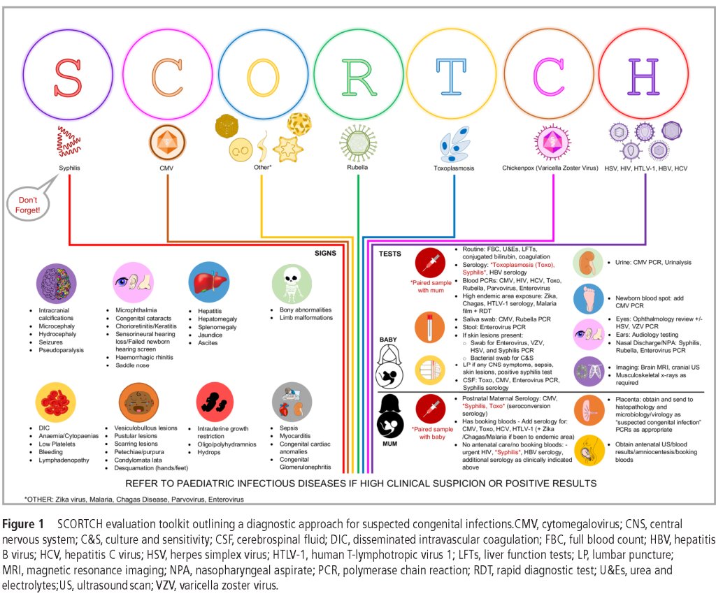 drtimothyli's tweet photo. Evaluation of suspected congenital infection➡️SCORTCH toolkit

S - Syphilis
C - CMV
O - Others (Parvovirus B19,Enterovirus,Zika virus,Chagas,Malaria)
R - Rubella
T - Toxoplasmosis
C - Chickenpox (VZV)
H - HSV,HIV,HBV,HCV,HTLV-1

https://t.co/AHOhzPWkyy https://t.co/9irqhBmOia