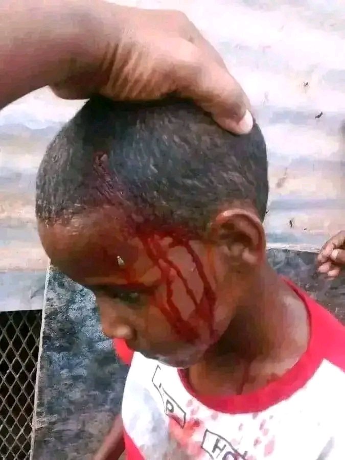 dankalia92's tweet photo. Innocent Afar children are being killed and injured at #yangulale district in Djibouti,however Djiboutian government until failed to stop the certain terrorist group who attacking civilians every day.
#yangulale_under_attack https://t.co/fLYQioyMBx