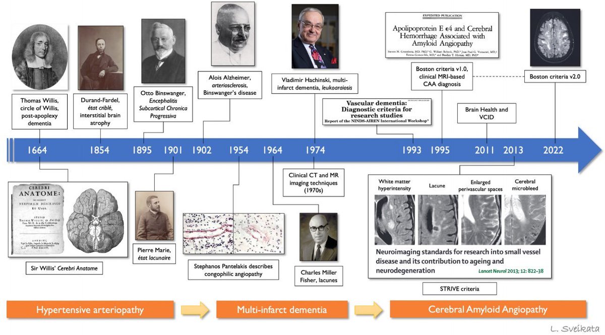 a_charidimou's tweet photo. 🧠Vascular Cognitive Impairment: Changing concepts

Kudos to @lsveikata for an insightful historical perspective! 🌟 Time bring small vessel disease & cerebral amyloid angiopathy into the spotlight.

#NeuroTwitter #NeuroRad #Neurology #Neurosurgery #stroke #MedStudentTwitter #FOAMncc #MedTwitter #amyloidangiopathy #FOAMncc #neuroscience #brain #Alzheimers #Alzheimer #illustration #neuropath #cSVD
