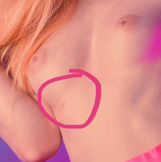 See this lil dot under my boob? Thats my third nipple. It gets hard like my regular nipples, but not