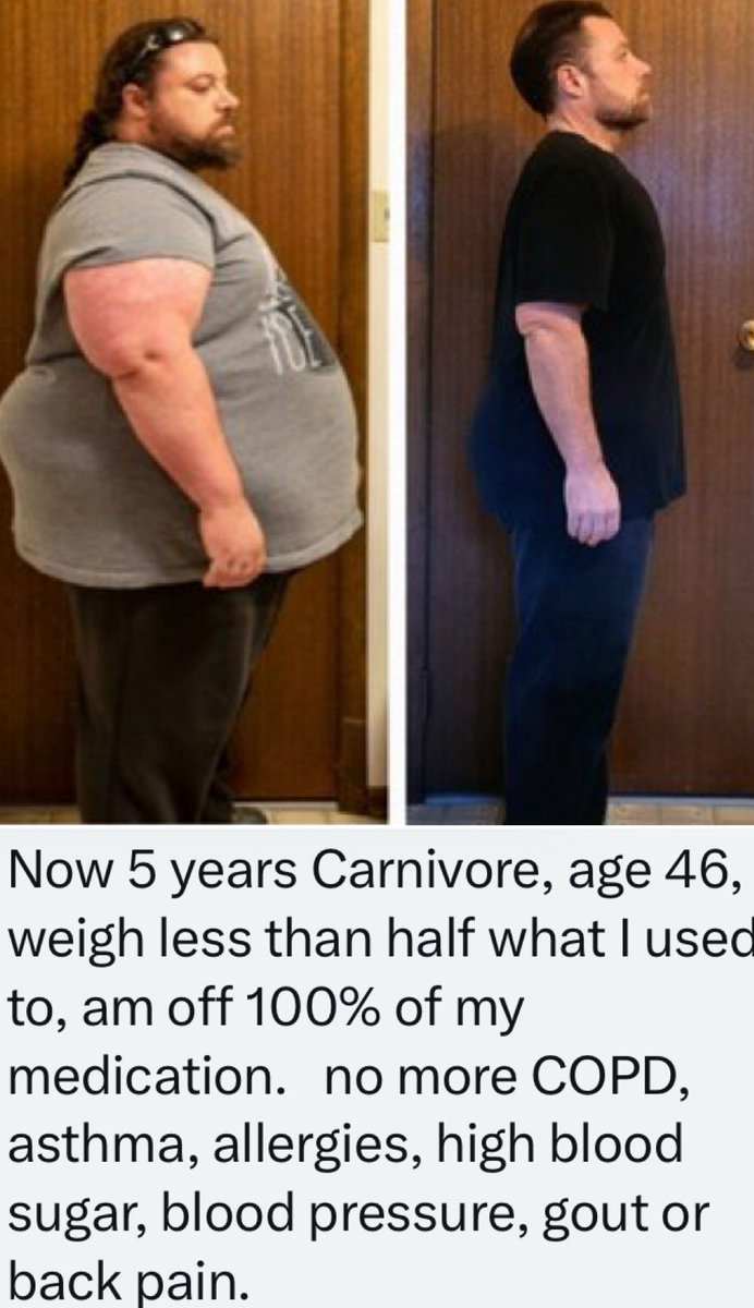 Dr Shawn Baker 🥩 tweet media