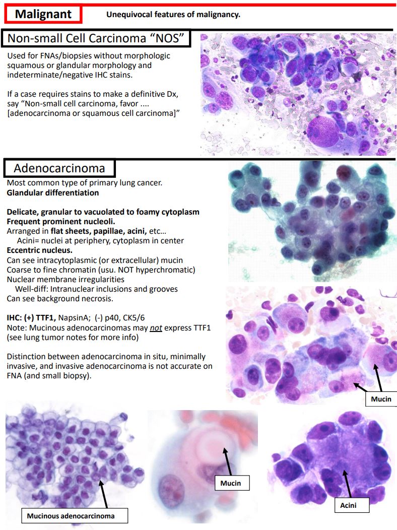 I posted my notes on Respiratory cytology, including the new IAC-IARC-WHO system, to my teaching website, "Kurt's Notes" (kurtsnotes.net).

🫁 🫁 🫁 🫁 🫁 🫁 🫁 🫁 🫁 🫁 🫁 🫁 🫁 🫁 🫁 🫁 🫁 🫁 🫁 🫁 🫁 🫁 🫁

Full notes available here: schaberg.faculty.ucdavis.edu/wp-content/upl…
