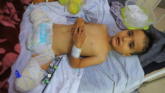 kijoteeh's tweet photo. 1200 niños lisiados permanentemente por los bombardeos de Israel hacia palestina #guerra #PalestineIsraelwar #crymua #israel #palestina https://t.co/vDjvUIMf9k