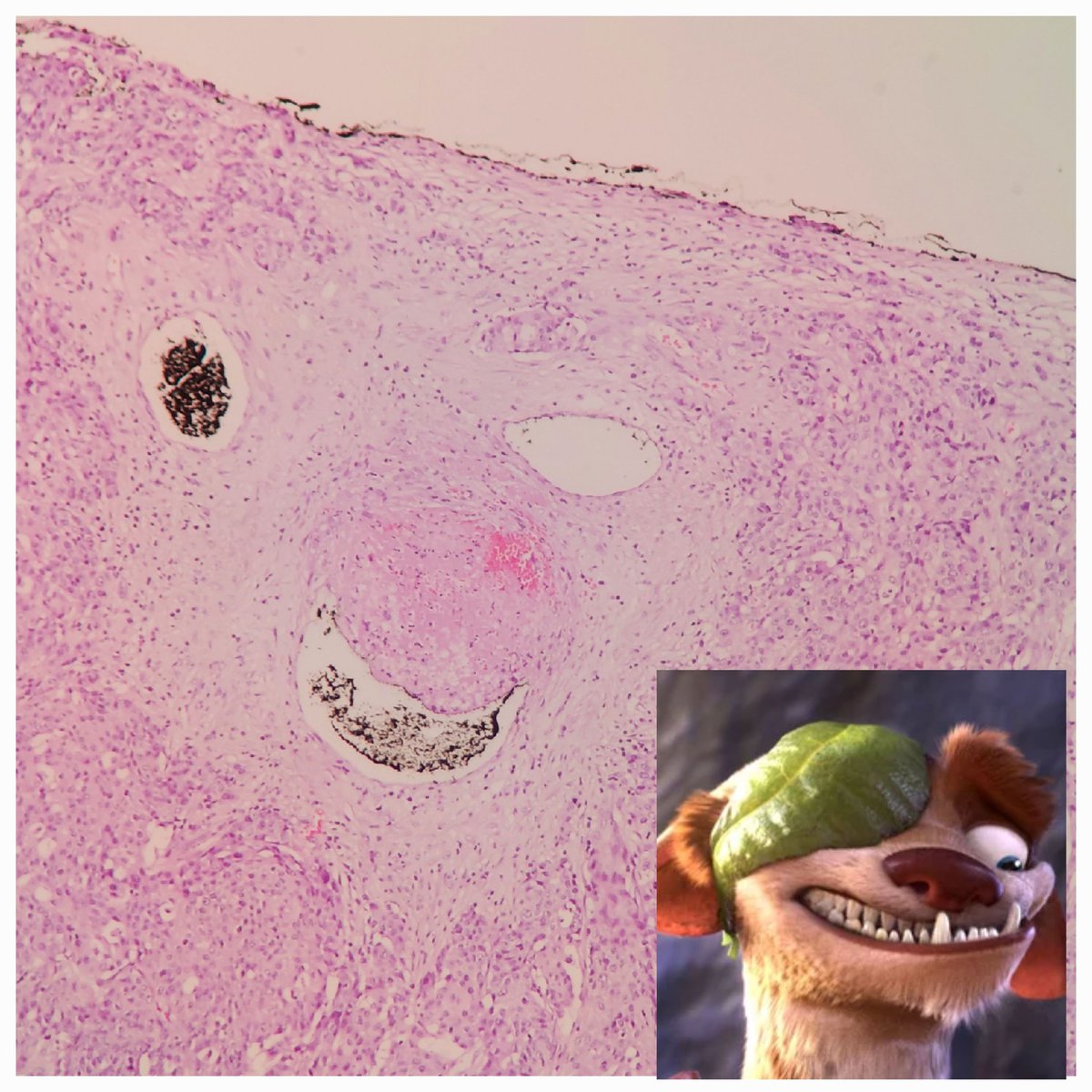 padmapathology1's tweet photo. Buck under my 🔬
#SmallLittleThings
#HappyNewYear2024
#PathTwitter https://t.co/E7q068TJx2