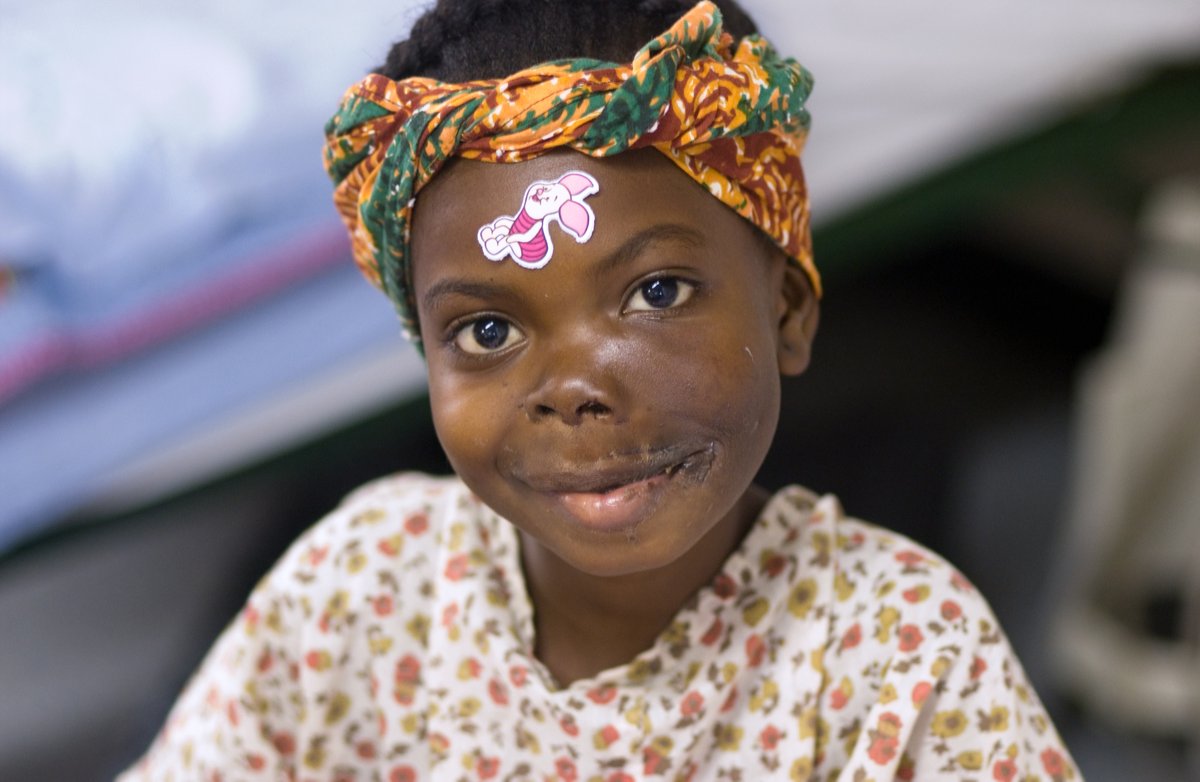 MercyShips's tweet photo. As a young girl, Hawa had a tumor growing in her mouth, limiting her ability to eat and drink. She remembers her hope slowly dying. Today, Hawa is living proof that hope is never lost. #yearinreview #bestmemories #hopeandhealing #yearofhopeandhealing https://t.co/Vf70AjTqxE