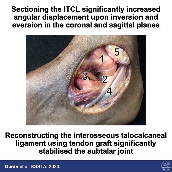 KSSTA's tweet photo. Insufficiency of the intertalocalcaneal ligament led to subtalar instability, which was redressable by autograft reconstruction.
#ankle #subtalar #foot #instability #reconstruction #biomechanics
Read here: https://t.co/4RUIWiuBaO https://t.co/TWiqh76nuX