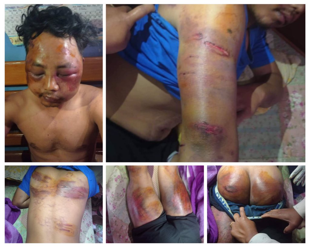 MOREH CDO ALLEGED OF THRASHING &amp; TORTURING CIVILIAN

One Moreh Youth namely Mr. Peter Mate son of Lamthang Mate and Tinnu Mate of Guite veng, Moreh was arrested by police commandos and beaten black-&amp;-blue.

Peter Mate - a teaching staff of Bethel English School, Moreh. and Youth