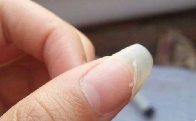 lo peor que te puede pasar