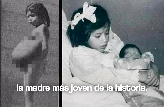 1spiderdan's tweet image. La Historia Completa de Lina Medina, la niña que dio a luz a los 5 años, su abusador nunca fue identificado.

Abro Hilo 🧵