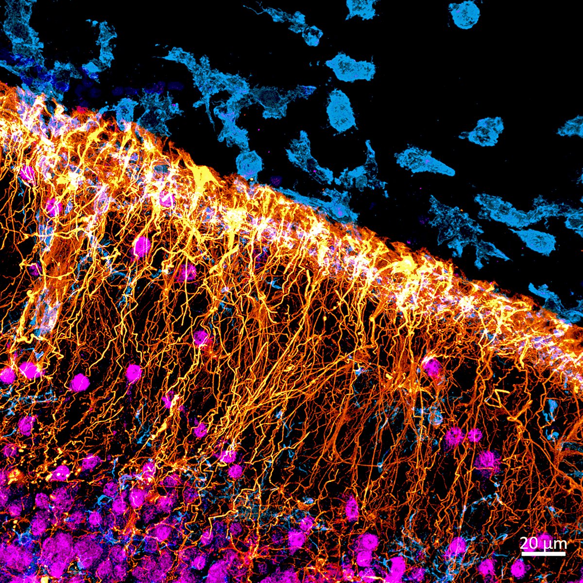 For the last day of the year, I want to share some of my favorite confocal images I took in 2023🥰! The one below shows the cortical expansion in the developmental brain of monkeys! Radial glia (🟠GFAP) is helping guide immature neurons (🟣SATB2) to find their final position