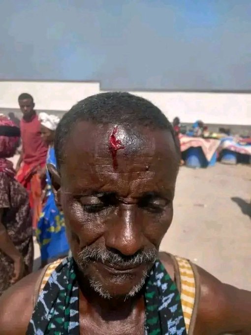 mominaytu_afar's tweet photo. An armed terrorist group of ISSA who sponsored by dictator regime, opened an attack on Afar civilian in djibouti, setting their homes on fire and leaving at least four civilians dead and numerous others injured.

#AfarUnderAttack

#Djbouti https://t.co/lN0CH2Ae34
