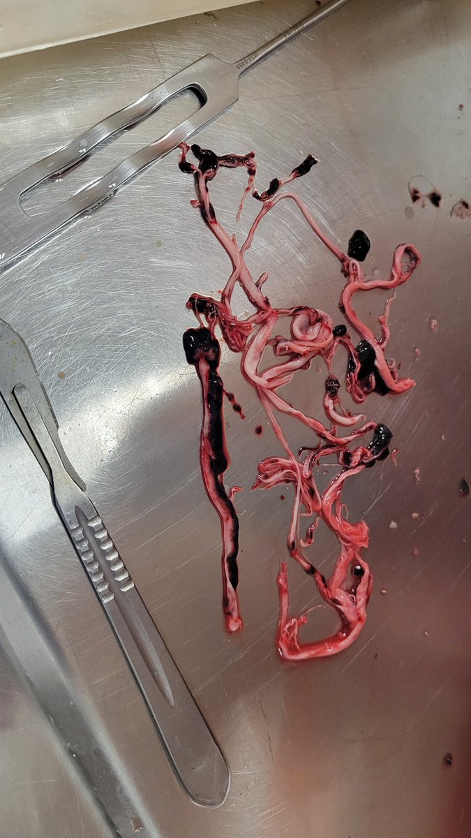 r_hirschman's tweet photo. I find it interesting how people try to discredit me and the evidence that I have shown because I am not a doctor, pathologist or scientist. These same people get their information from reporters and journalists who are not doctors, pathologists or scientists!
I have been speaking to and assisting doctors, pathologists and scientists! I have provided the evidence and they continue to try and understand what is and how and why it is happening to this day! I wish I had all the answers, but I don't. Hopefully in time we will all come to an agreement and work on solutions in order to help everyone! Until then...
Seek truth and God.
Be kind.
Try to do what is right ✅️