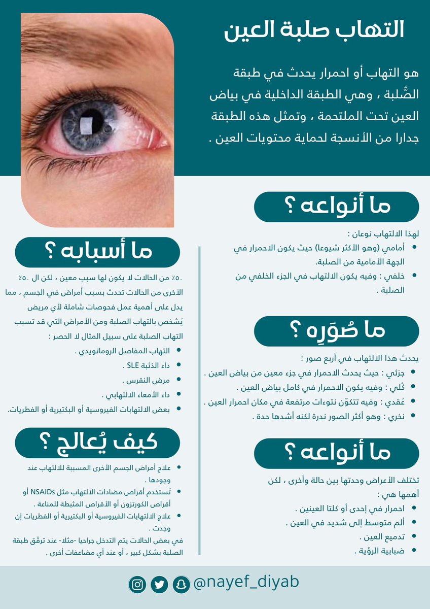 أحد أسباب إحمرار العين هو التهاب صلبة العين

#صحة_العين