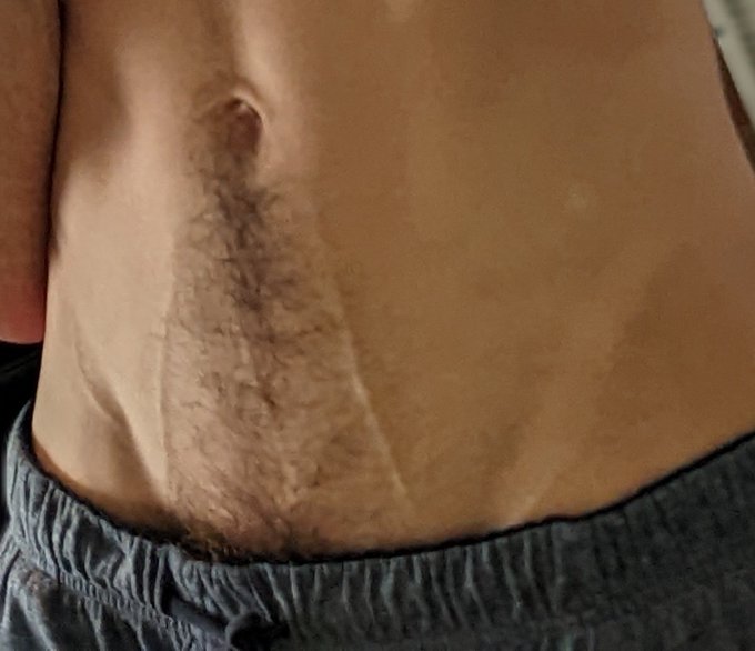 Veins go brrr https://t.co/lnBDBULl6o