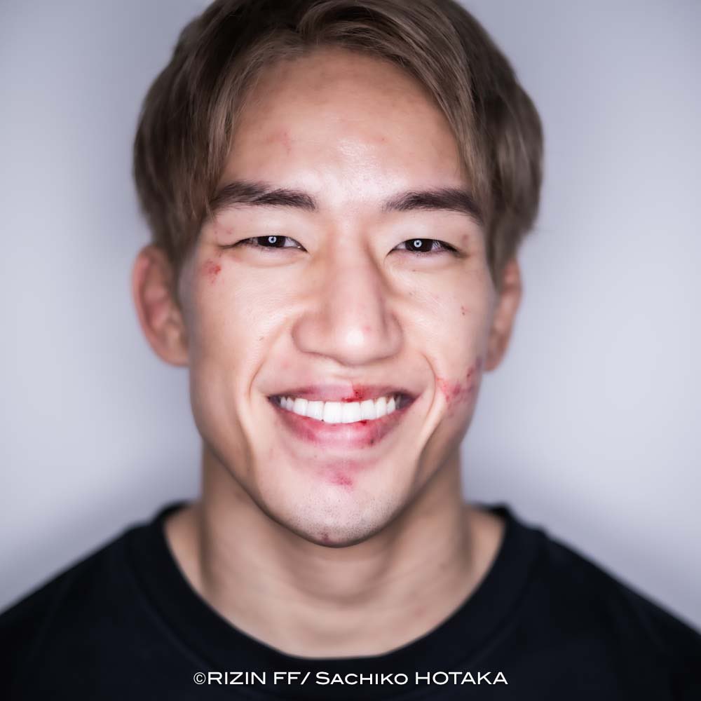 greco_free's tweet photo. 【#朝倉海 @kai_1031_】
#RIZINの漢たち -闘いのあと-

#postfightportraits #scars_wounds_emotions #RIZIN #試合後ポートレート 

#RIZIN45
2023年12月31日（日）
さいたまスーパーアリーナ
👑第6代RIZINバンタム級チャンピオン https://t.co/sbT8n7R1gv
