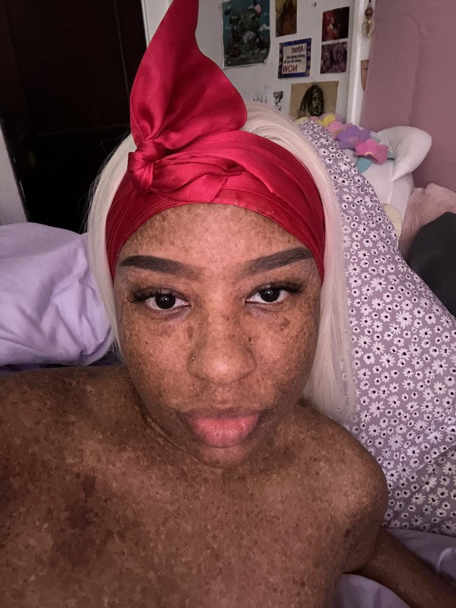 freckledn's tweet photo. Last melt of the year lmfao https://t.co/T7ZHMgxZZ8