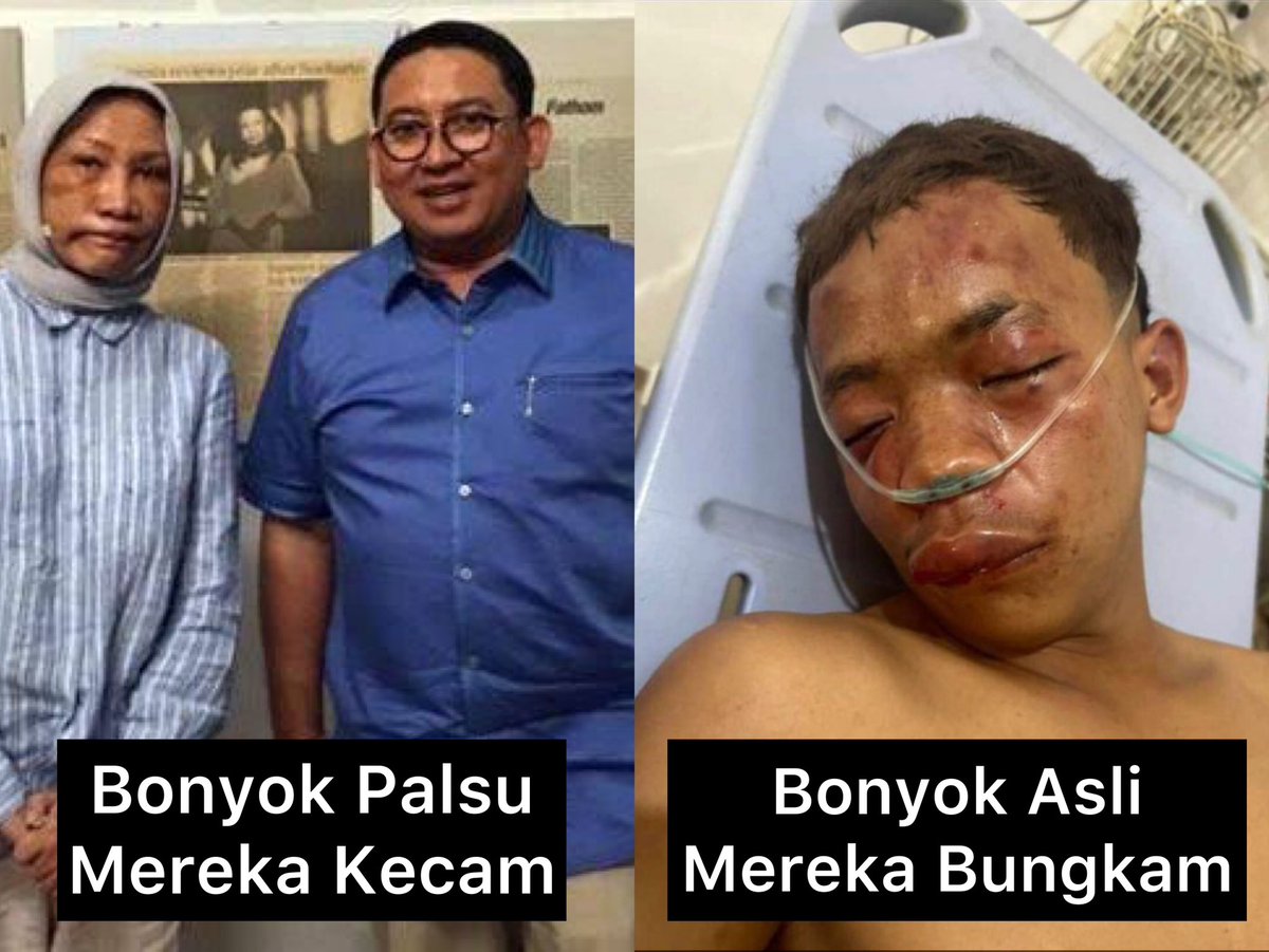 yusuf_dumdum's tweet photo. Masih ingat kasus Ratna Sarumpaet yang diklaim para jongos penculik katanya digebukin (padahal oprasi plastik) ?

Mereka sampai nekat bikin konpers untuk membohongi publik dan disaksikan oleh jutaan rakyat Indonesia. @fadlizon dan @Fahrihamzah bacotnya gak kira-kira. 

Sekarang ketika ada kasus relawan Ganjar-Mahfud di Boyolali digebukin secara brutal, dan bahkan ada kejadian lain di Sleman hingga meninggal, banyak para jongos penculik malah mendukung perbuatan keji dan biadab itu.

Gerombolan seperti mereka sangat berbahaya jika berkuasa. Bagi mereka, politik ditempatkan di atas kemanusiaan, etika dan moralitas. Makanya tidak heran apabila mereka mendukung kekerasan dan akan melakukan apapun demi politik dan kekuasaan. Padahal harusnya sebaliknya, kemanusiaan di atas politik.

Kita tidak tahu kapan hal serupa akan menimpa keluarga kita. Jangan sombong dan semena-mena. Dari semua kejadian ini kita semakin tahu, bahwa politik riang gembira dan santuy yang digembar-gemborkan mereka ternyata palsu!

Jangan kendor, lawan narasi jahat para jongos pendukung kekerasan dan capres penculik !✊
