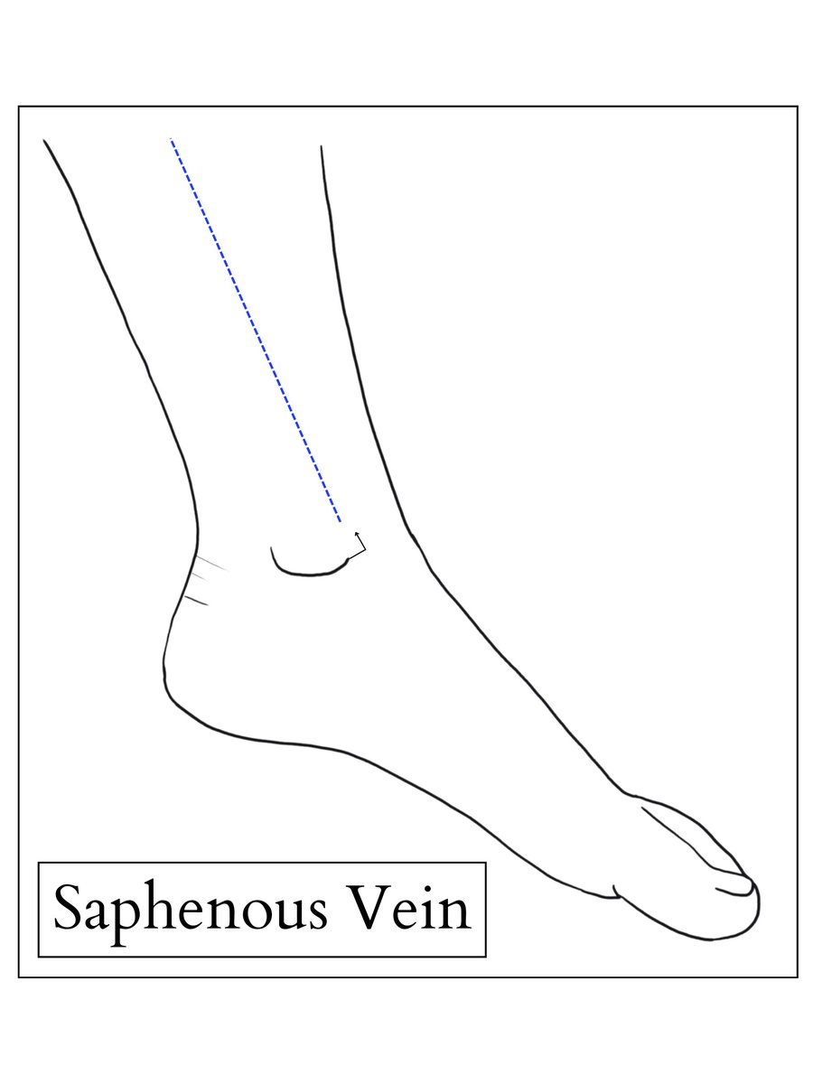 baby_blocks's tweet image. As we hunker down for the season, we offer one final gift, an homage to our most popular page, blind IV access: A new printable PDF for quick and easy access.
And no, the irony isn't lost on us.
baby-blocks.com/vascular-acces…
#PedsICU #pedsRN #pedsED #pedsanesthesia #pediatrics