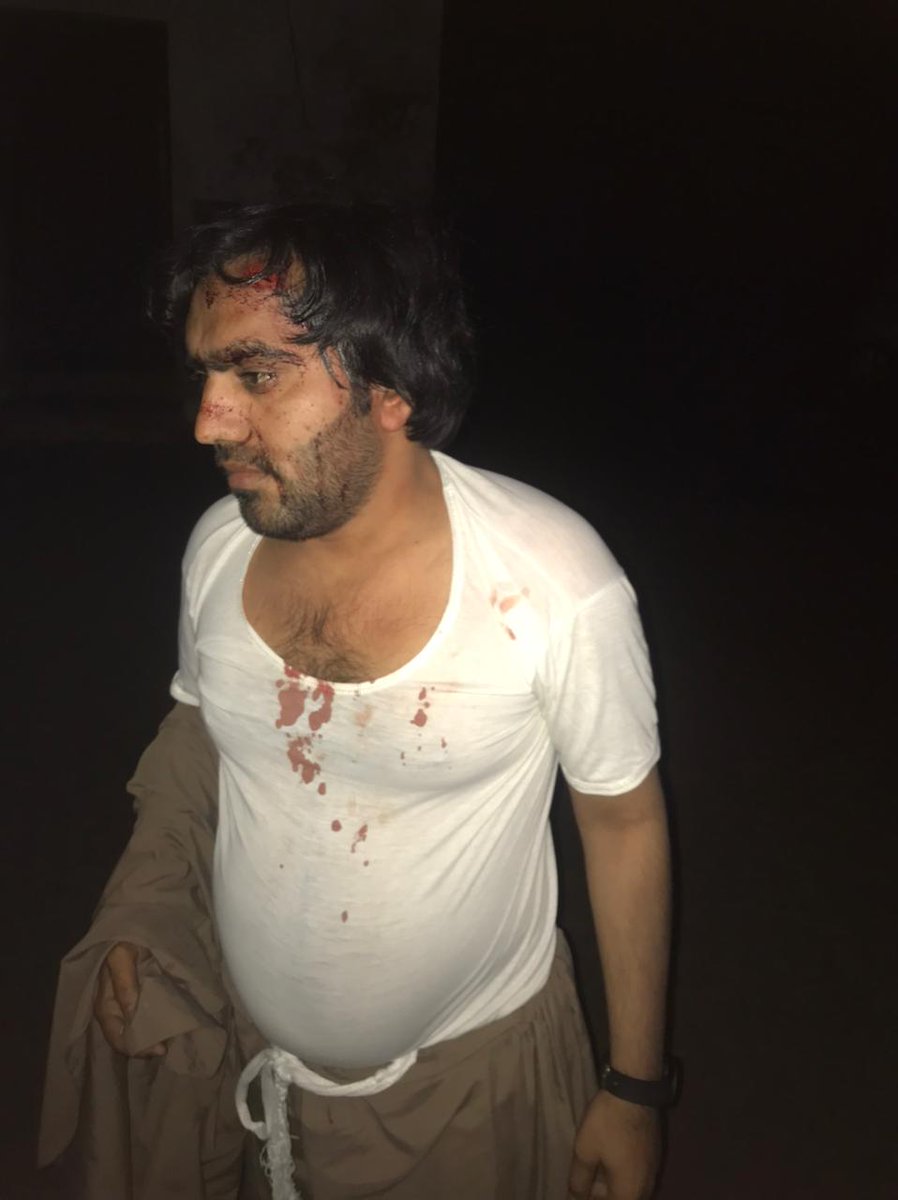 psfmansoor's tweet photo. پی ایس ایف ضلع قمبر شہدادکوٹ کے صدر صدام حسین سومرو اور اس کے بھائی کے اوپر قاتلانہ حملا ہوا ہے جس کی ہم سخت الفاظوں میں مذمت کرتے ہین 
آء جی سندھ اور ایس ایس پی قمبر سے مطالبہ کرتے ہیں کے جوابداروں کو جلد سے جلد سلاخوں کے پیچھے ڈالے ورنہ پورا سندھ اپنہ رد عمل دیگا۔ https://t.co/JNfVQgaSTK