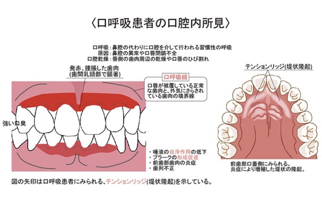 GCtcqyGboAAqLA6.jpg?format=jpg