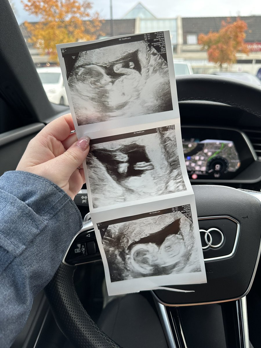 New Year, New Adventure 🥂

Baby Coming April 2024 🍼💕
<a href="/CyrusTv3/">CyrusTWO</a> 

Happy New Year ✨🥂