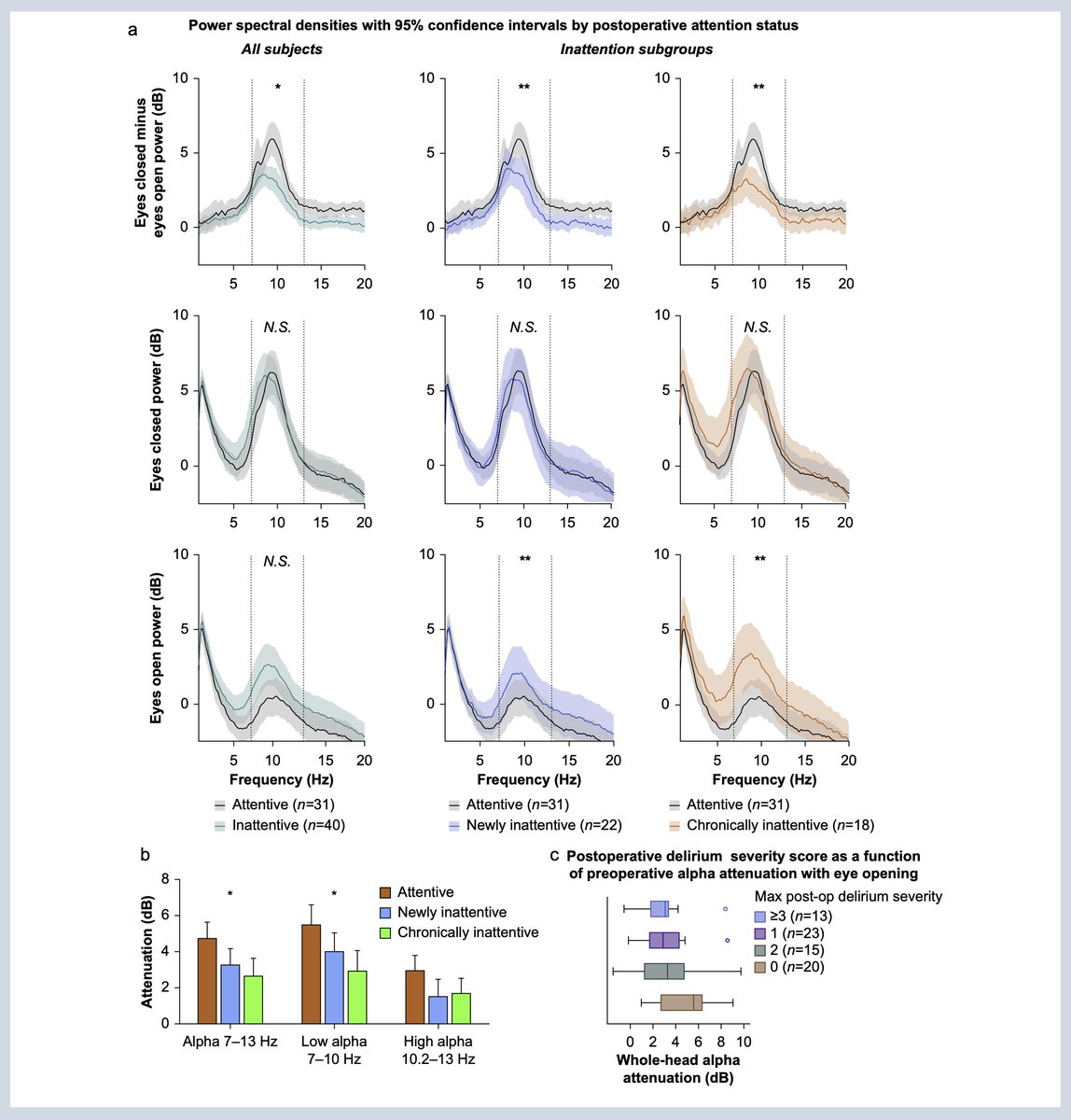 BJAJournals's tweet image. FREE TO VIEW. Preoperative electroencephalographic alpha-power changes with eye opening are associated with postoperative attention impairment and inattention-related delirium severity. New study by Acker et al 

#pEEG #anaesthesia #delirium #openaccess

bjanaesthesia.org/article/S0007-…