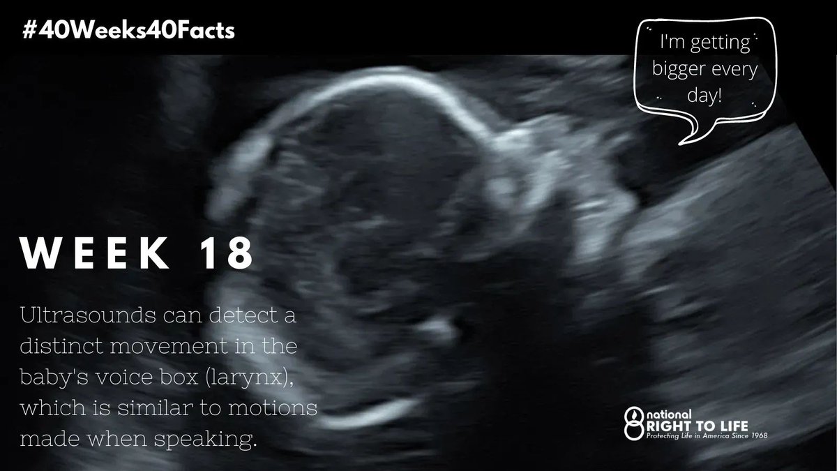 nrlc's tweet photo. Week 18
Movement, breathing activity & heart rate start to follow circadian rhythms.
Abortion proponents will say that at 20 weeks & before it's "junk science" that they can feel pain. This is wrong & why we work on #prolife legislation like the #PainCapable Act
#40weeks40facts https://t.co/3QyZRhYi8A
