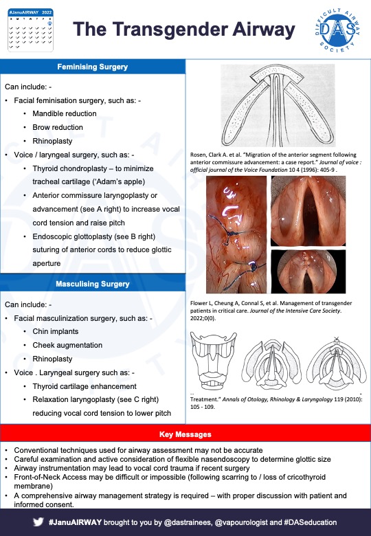 Welcome to #JanuAIRWAY2024. Every weekday we'll be bringing you Airway #FOAMed. Starting off with management of transgender airway -here's a #OnePager. It's a huge topic going beyond just the airway. Thanks to Drs @LukeFlower1 @drkamillak & Alice Humphreys for all their help! 1/7