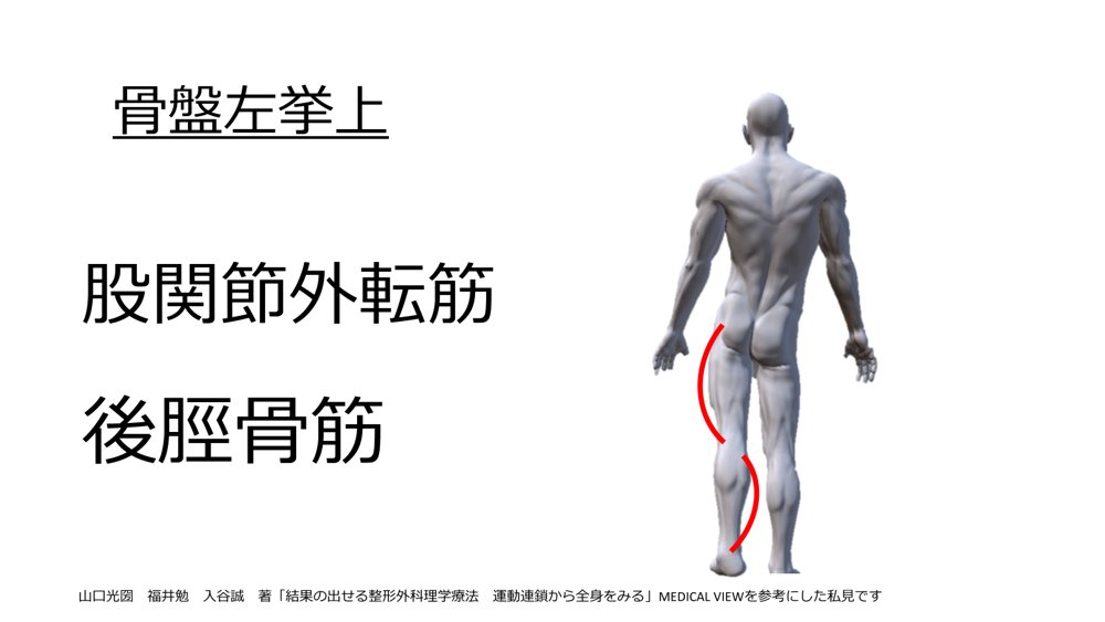 miya366494678's tweet photo. 骨盤の挙上、移動位を確認すると負担のかかっている筋肉を予測することが出来ます
骨盤の動きは歩行観察でも比較的見やすい所なので、骨盤の挙上は出現するか？どちらに移動するか？を注意しながら歩行を観察してみてください
そうすると特に股関節周囲の症状と歩容を結びつけることが出来ます https://t.co/aXPrRiOmQL