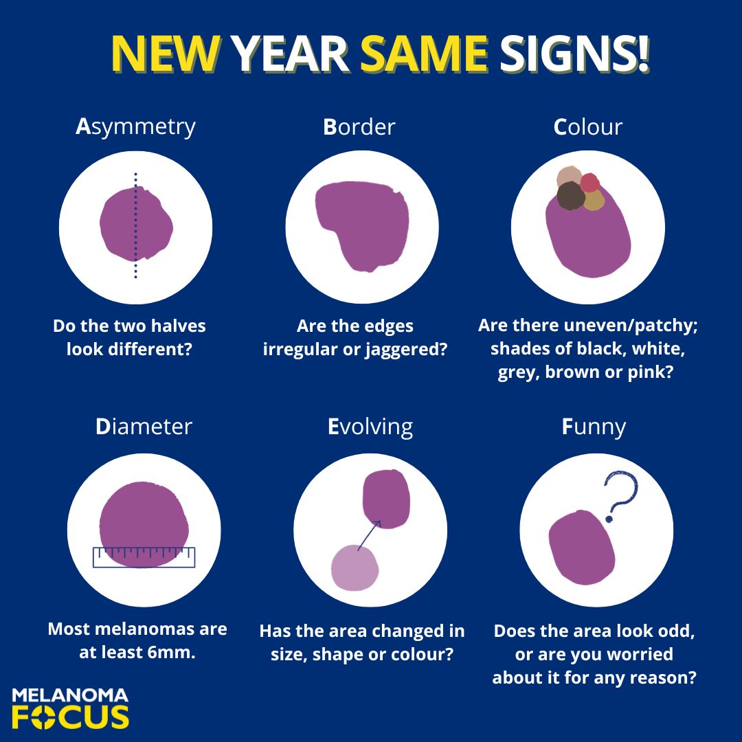 It's a New Year but the signs of melanoma skin cancer are the same. 📆 

Make monthly skin checks one of your 2024 resolutions and get to know the signs. 🔎

Skin check leaflet 👉 buff.ly/3N6K3nZ
