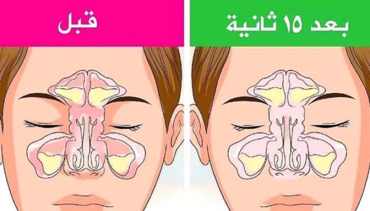 🚨علاج انسداد الأنف في دقائق :

يمكنك الإعتماد على بعض العلاجات المنزلية الطبيعية البسيطة التي تساعدك على التخلص من إنسداد الأنف المزعج، و تشمل هذه العلاجات ما يلي 👇🏻

نصيحة : اذا مشغول فضلها وارجع لها بعدين