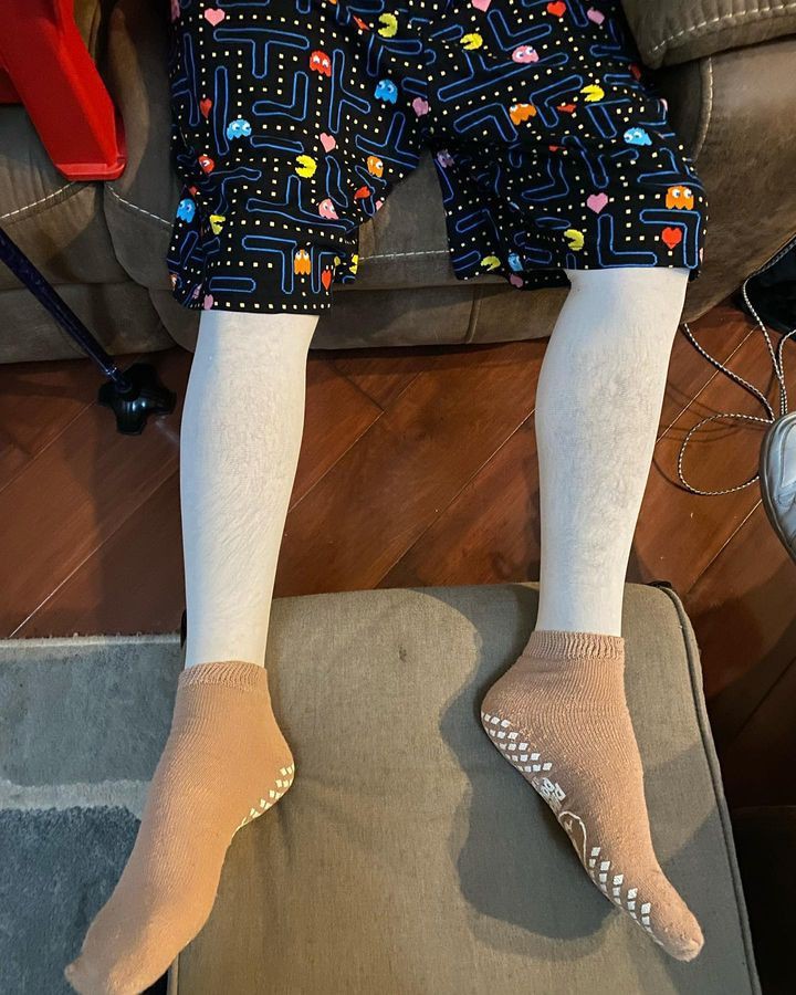 noksikson's tweet photo. i still can't believe some of yall thought his legs were THIS white 💀💀 https://t.co/eWedwwHI3k