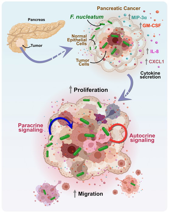 ScienceMagazine's tweet photo. The commensal bacteria #Fusobacterium can promote the migration of #PancreaticCancer cells, according to a 2022 @SciSignal study highlighting the growing importance of the #TumorMicrobiome in cancer progression and therapeutic research. 

Read more: https://t.co/XtkxgVuptV https://t.co/gKzmsMbFbW