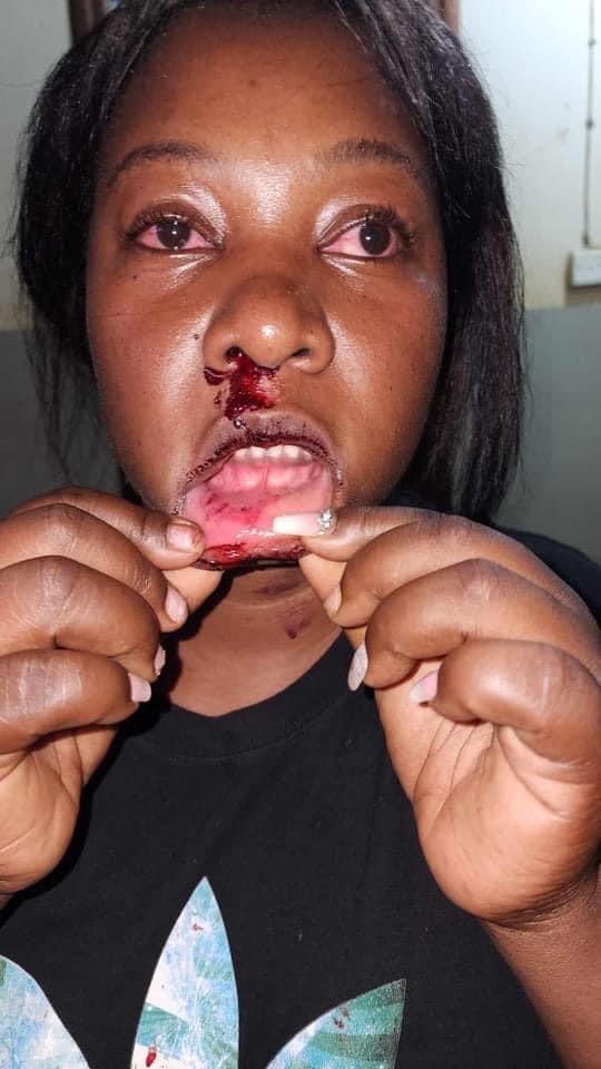 This man Below Is called Micheal Ssenyonjo, a  resident of Bulindo - Nsasa, he runs a restuarant ( Plush) on Kira he has been beating the wife like a thief for the last 2Years, and whenever she reports to Kira Police Division, she never gets Justice.
I Condemn GBV <a href="/PoliceUg/">Uganda Police Force</a>