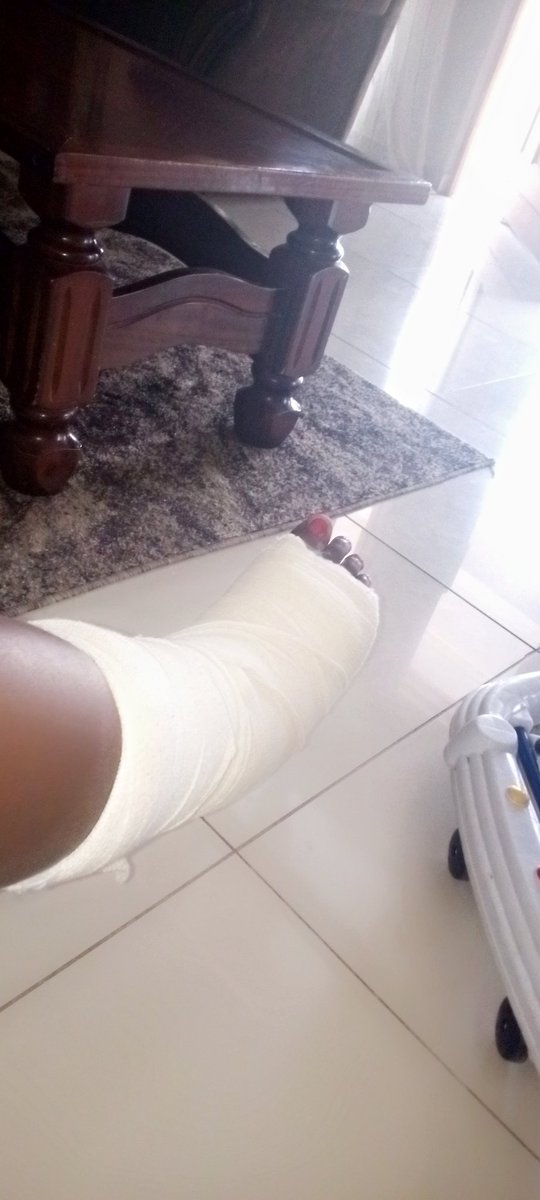 Broke my ankle and wow being unable to get up &amp; go is a miserable experience in my life 🦶