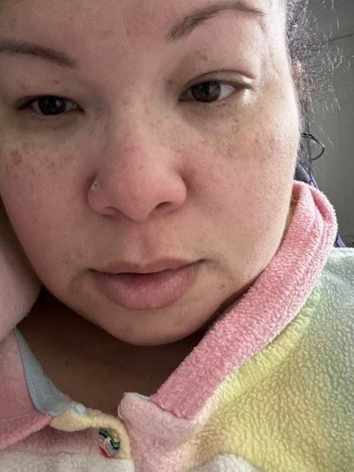 Well, it was not a normal sickness, it is Covid!😩🤧🤕 I had to go to the hospital because the online Dr<a href="/tag/mvsales"class="tags"><span>#mvsales</span></a>