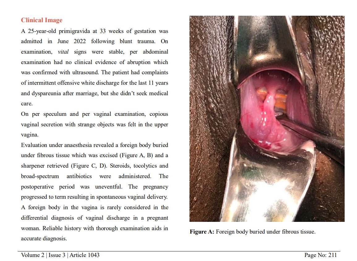 Contusm_Publish's tweet photo. "Forgotten Foreign Body in a Pregnant Woman."

Read it here: https://t.co/XyuElA4bCZ

#PregnancyComplications #ForeignBody #MedicalCaseReport #Obstetrics #WomenHealth #ResearchInsights #MaternalHealth #CaseStudy #HealthScience https://t.co/Wv2IMNHhWP