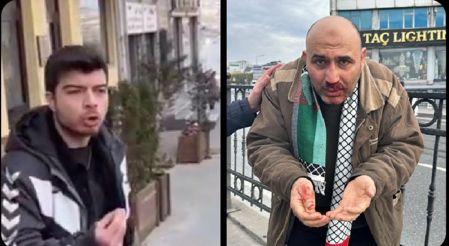 Cezası müebbet hapis olan hilafet isteyene  hiç bir işlem yapılmadı

Hilafet isteyene yumruğu vuran 
Tutuklandı

Hilafet isteyeni darp eden cocuğa polisin önünde yumruk atan şahsa hiç bir işlem yapılmadı

Adaletini silktiğim ülkesinde kalk sen bir de avukat ol